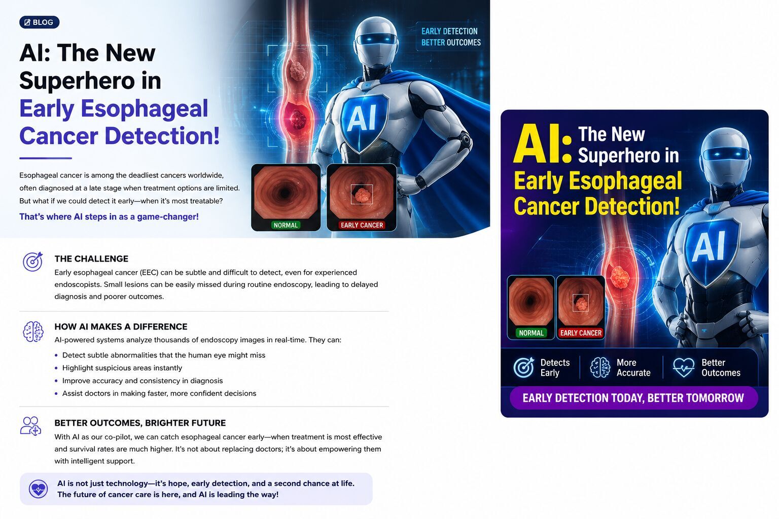 early-esophageal-cancer-detection-how-ai-helps-doctors-find-cancer-faster-image